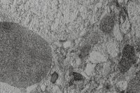 Kaboompics - Dark Gray and White Coarse Stone Texture
