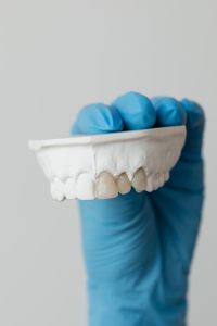 Kaboompics - Vertical View of Upper Dental Model With Copy Space