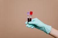 Kaboompics - Gloved Hand Holding Blood Test Tubes Against Beige Copy Space, Laboratory Health Background