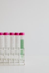 Kaboompics - Pink-Capped Test Tubes in Laboratory Rack