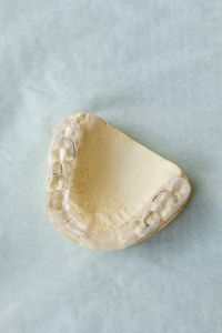 Kaboompics - Transparent Orthodontic Retainer on Lower Jaw Model