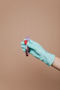 Kaboompics - Blood Sample Tubes in Gloved Hand with Beige Copy Space, Vertical Laboratory Background