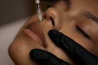 Kaboompics - Close-Up Facial Injection Near Nose and Upper Lip
