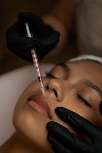 Kaboompics - Cosmetic Lip Filler Injection with Syringe and Gloves