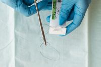 Kaboompics - Overhead View of Surgical Suture Setup on Blue Drape