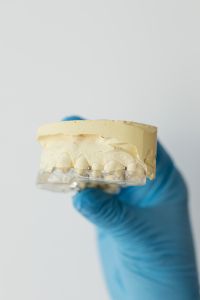 Kaboompics - Dental Bruxism Splint Held in Blue Gloved Hand