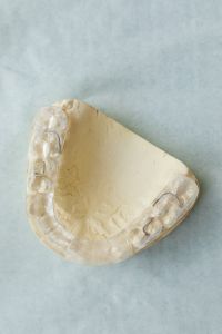 Kaboompics - Detail of Clear Removable Dental Retainer on Plaster Cast
