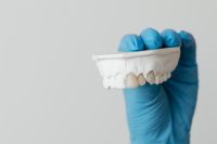 Kaboompics - Upper Jaw Dental Cast on Blue Gloved Hand